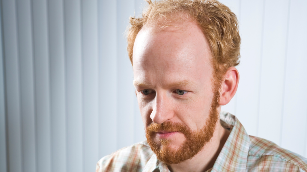 Hommes roux, voici 5 plans de jeu si vous faites face à la perte de cheveux