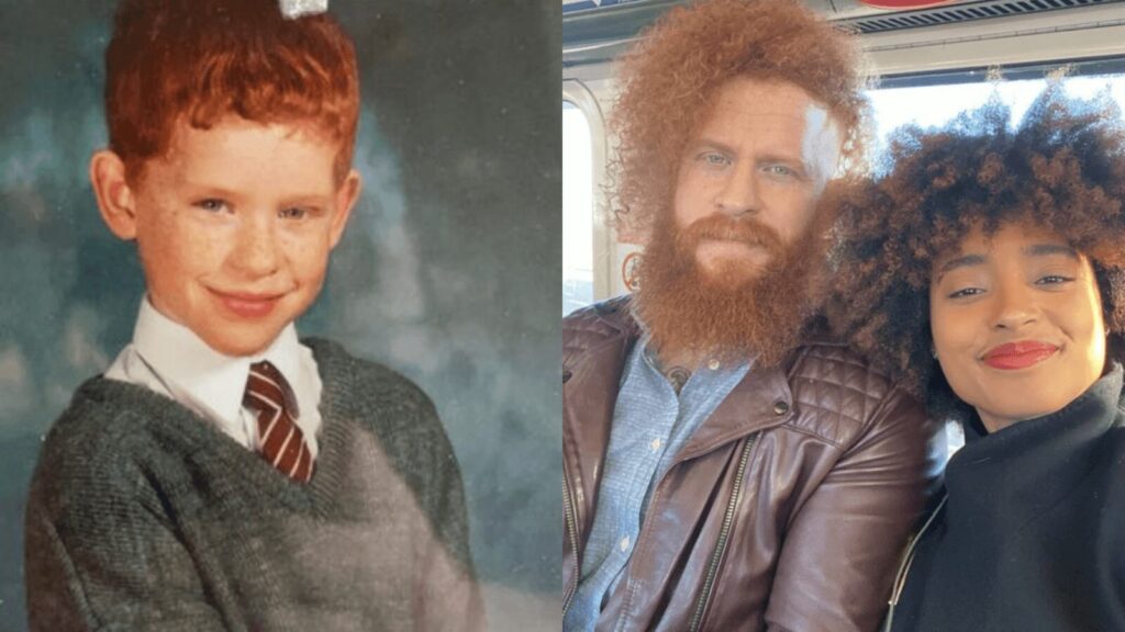 Comment cet homme roux a-t-il grandi avec des cheveux roux