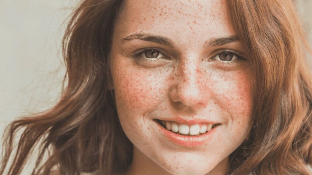 Pourquoi les taches de rousseur s'estompent-elles à mesure que les rousses vieillissent ?  Nous avons les réponses