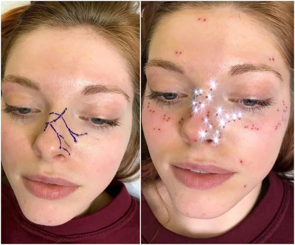 Nouvelle tendance : tatouages ​​​​de taches de rousseur de constellation basés sur votre signe astrologique