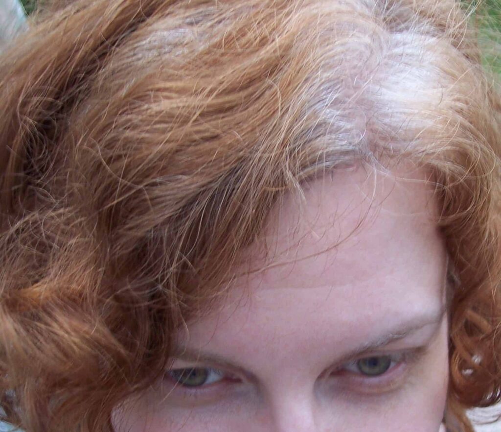 C'est vrai : le stress rend les cheveux gris (et les rousses, c'est réversible)