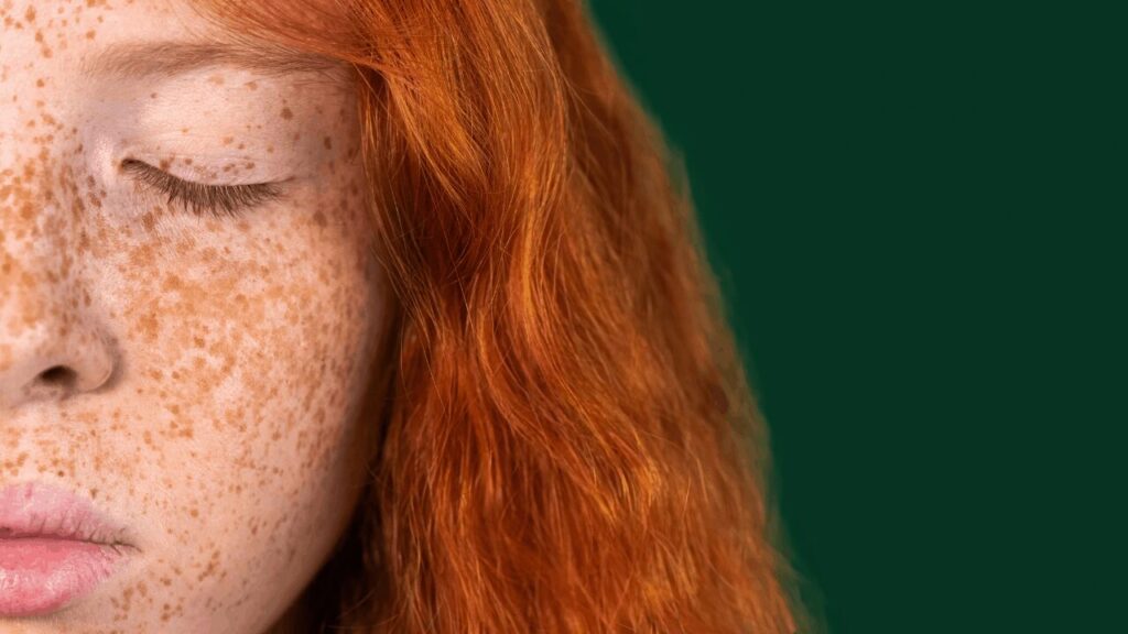 Rousses : qu'est-ce que vos taches de rousseur essaient de vous dire ?