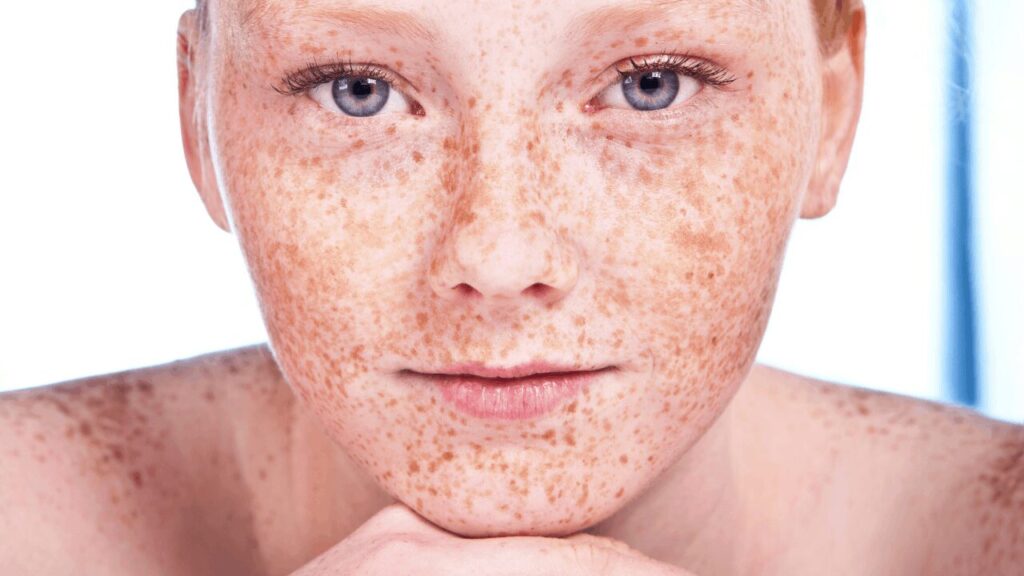 5 conseils de maquillage que toute rousse avec des taches de rousseur devrait connaître