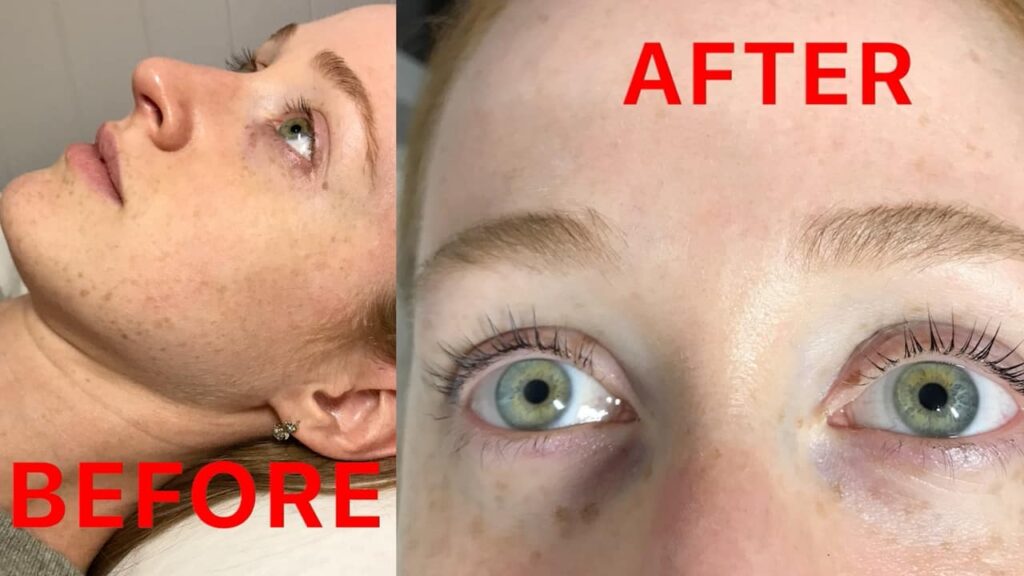 Ce que chaque rousse doit savoir sur le lifting des cils