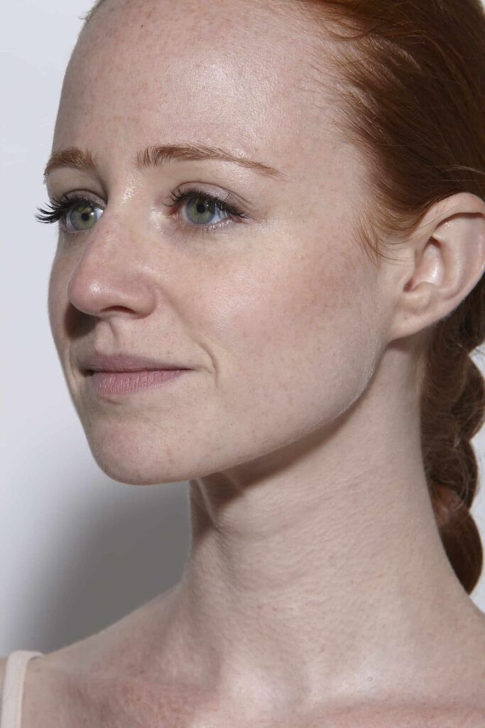 Saviez-vous que la plupart des rousses ont la peau couperosée ?