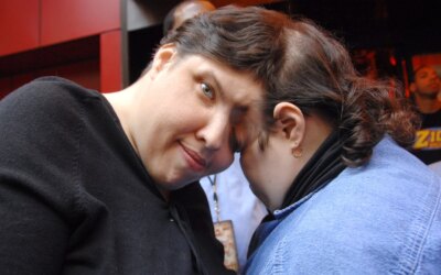 Un jumeau siamois a gardé l&rsquo;identité secrète de sa sœur pendant des décennies, puis est devenu trans à 46 ans