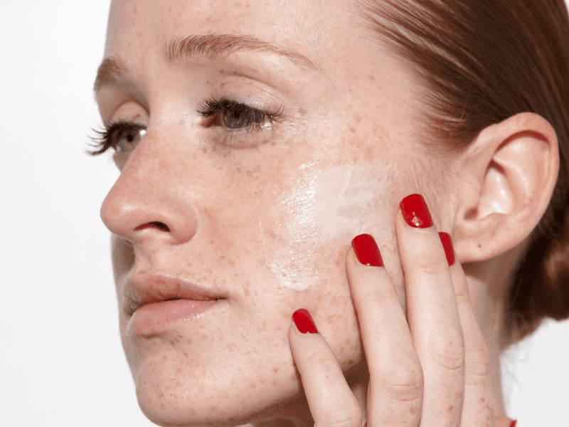 Tretinoin
