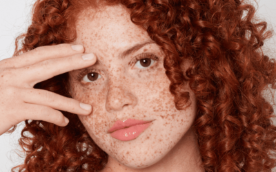6 meilleures recettes de soins de la peau DIY pour les rousses