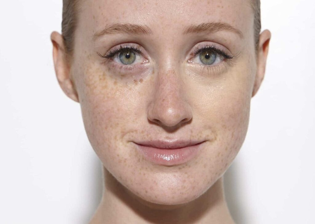 6 zones pour appliquer un correcteur sur votre peau rousse
