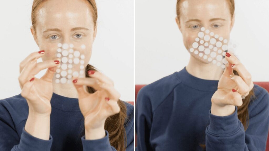Comment les rousses peuvent se débarrasser de l’acné de la racine des cheveux