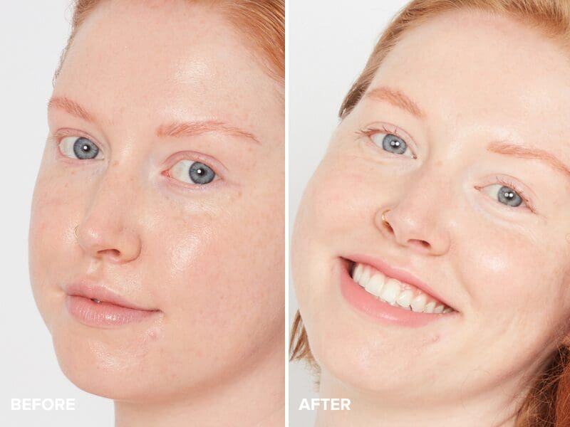 concealer redhead